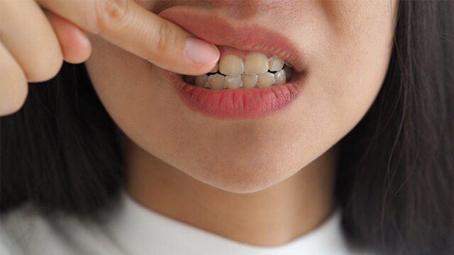 Casal escovando os dentes para remover a placa bacteriana