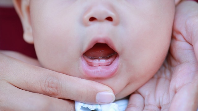 Dentes nascendo em um bebê