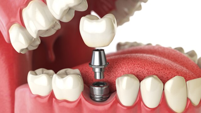 procedimentos de odontologia estética
