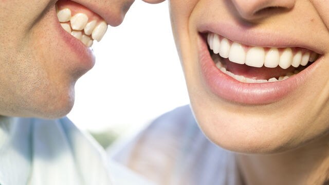 casal-com-dentes-perfeitos