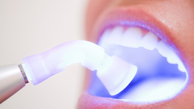 Pessoa realizando clareamento dental com luz de LED em consultório para remover manchas e conquistar um sorriso mais branco.