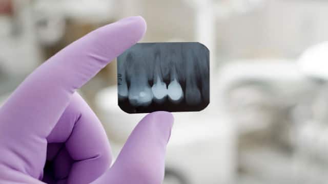 Compreensão de radiografias dentárias