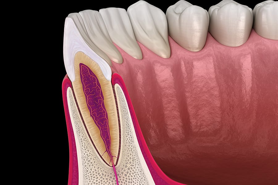 Ilustração 3D odontológica da anatomia dos dentes superiores