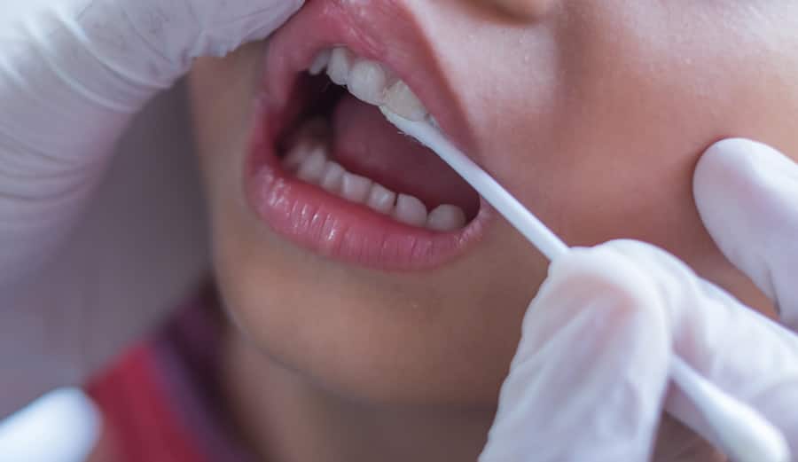 Criança recebe medicamento com flúor na boca por um dentista