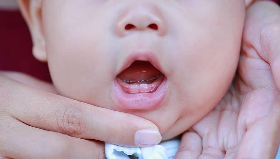 A mãe abre a boca do bebê para examinar os primeiros dentes.