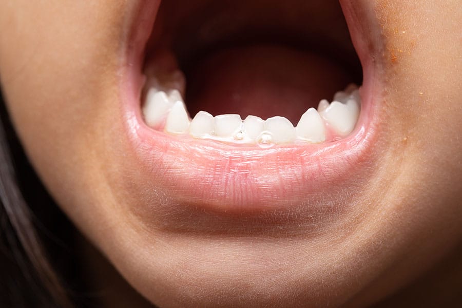 Menina com boca aberta para dentista verificar os seus dentes
