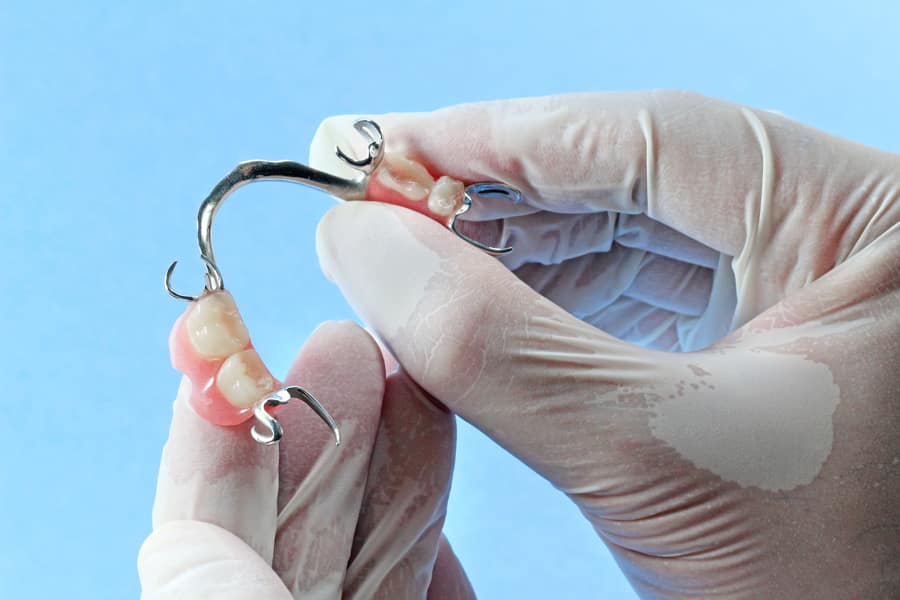 Mão de dentista segurando prótese parcial removível