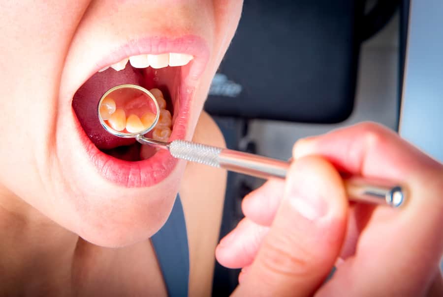 O espelho do dentista na boca de jovem reflete a parte posterior dos dentes da frente