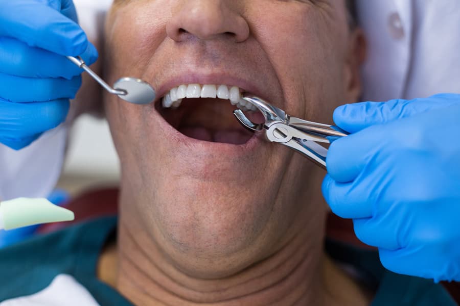 homem no dentista realizando procedimento odontológico