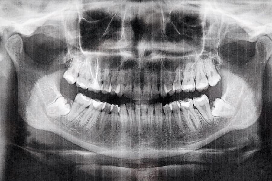 raios-X dentário