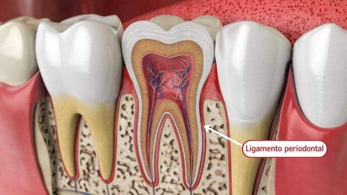 Ilustração que mostra onde fica o ligamento periodontal, localizado entre o osso e o dente.