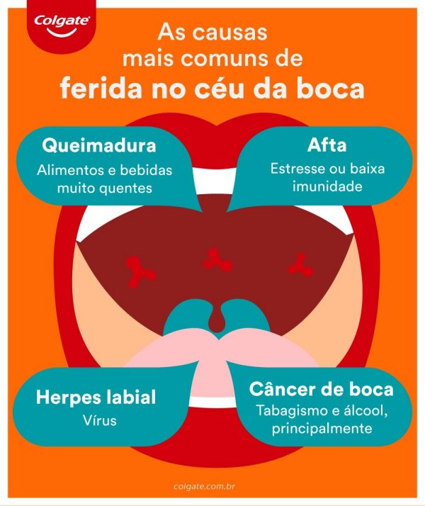 Infográfico sobre feridas no céu da boca