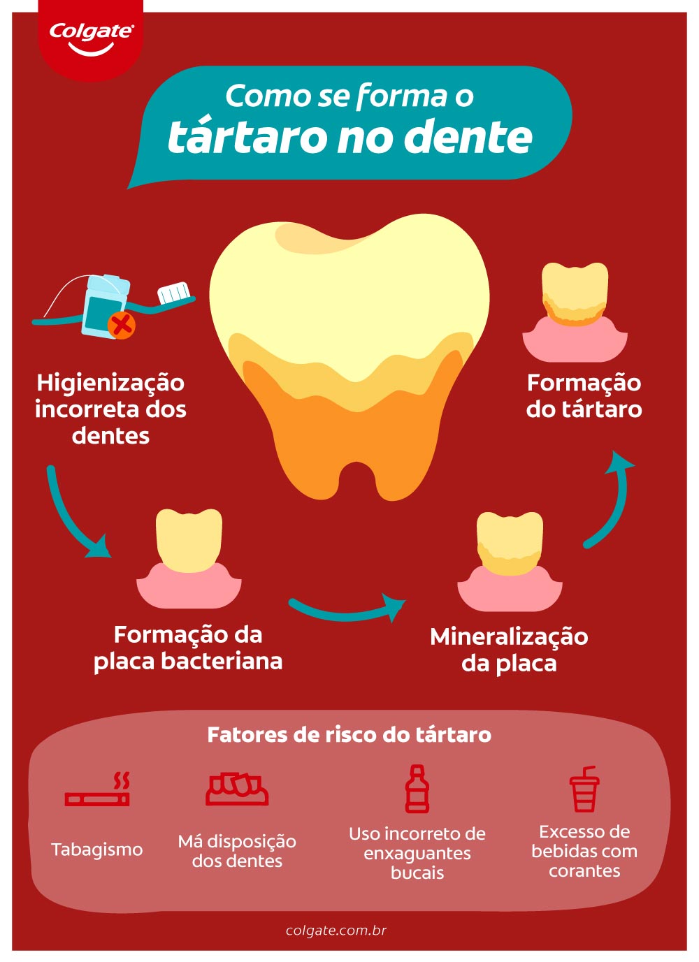 Infográfico sobre como se forma o tártaro no dente.
