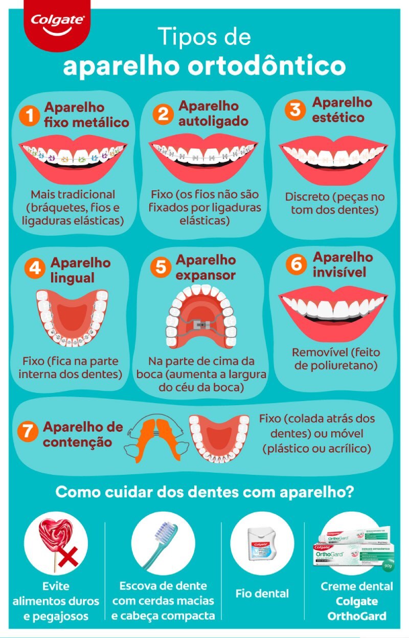 Infográfico sobre tipos de aparelho