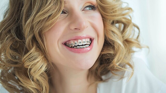 Mulher sorrindo com aparelho ortodôntico bom borrachinha cinza, destacando as melhores cores de aparelho para um sorriso elegante e discreto.